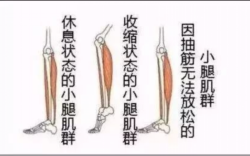 為什么會抽筋？抽筋對老年人也有很大的危害。