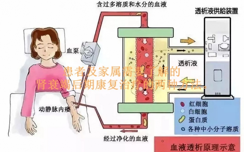 患者及家屬需要了解的腎衰竭后期康復治療的兩種方法