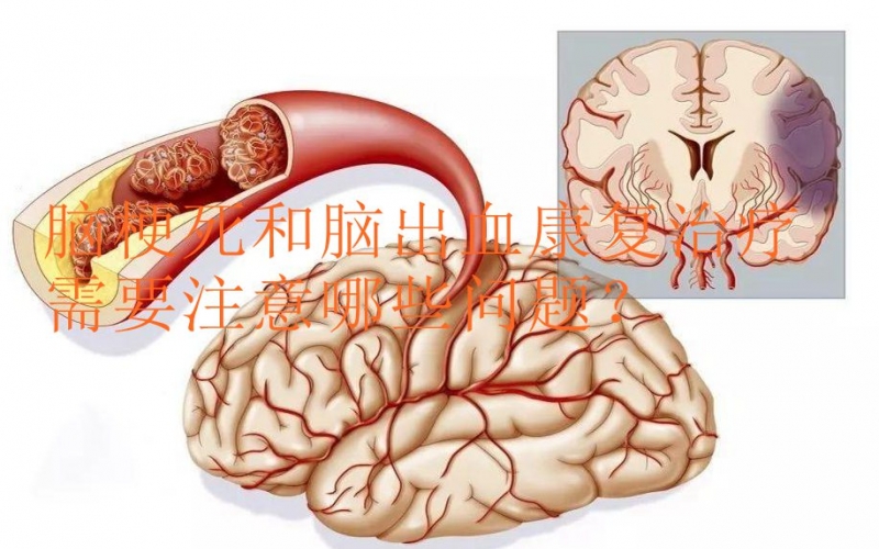 腦梗死和腦出血康復治療需要注意哪些問題？